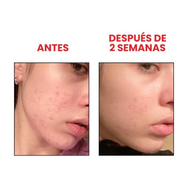 ANUA Niacinamida 10%